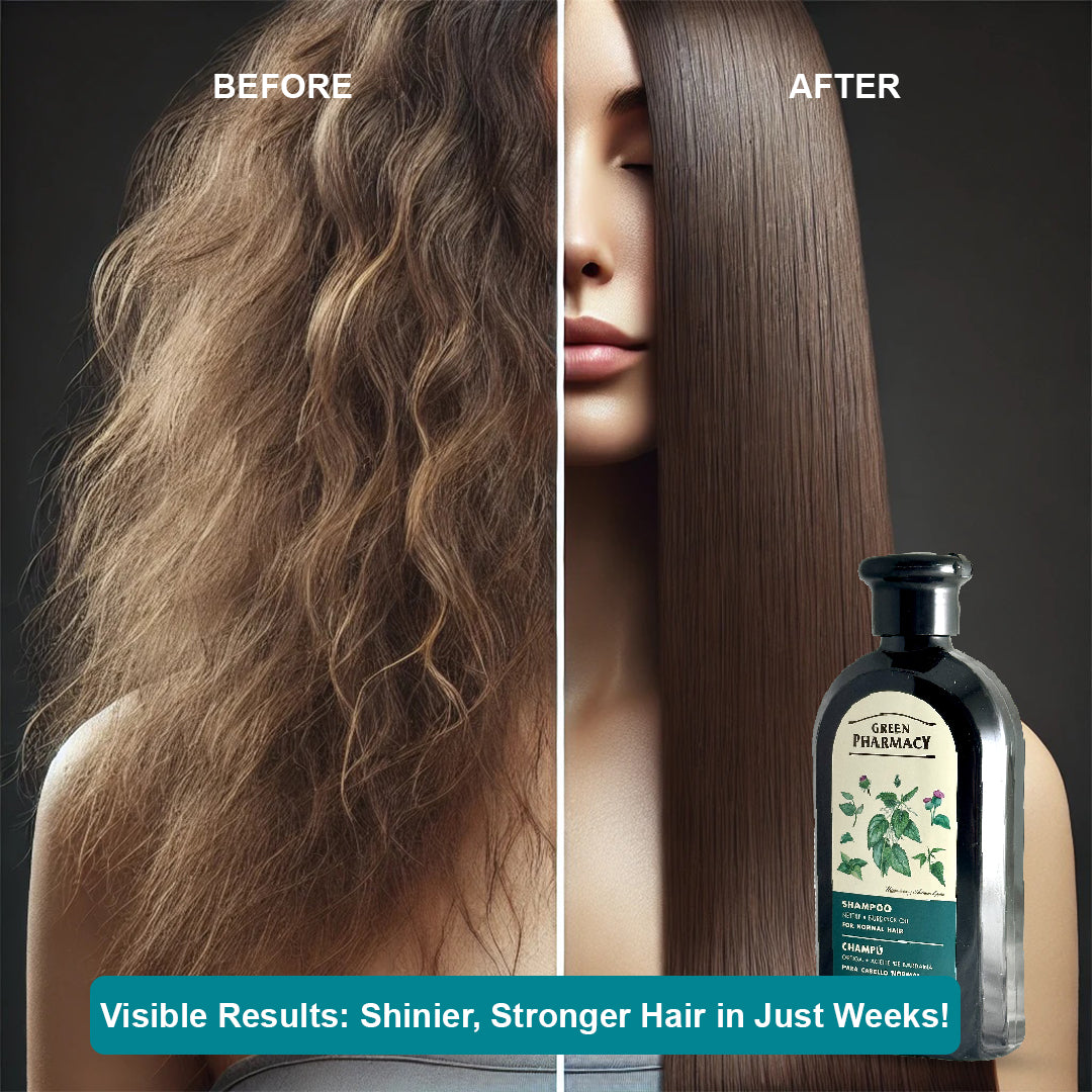 Nettle & Burdock Oil Shampoo for Normal Hair, 350 ml / 11.83 fl.oz – Strengthens Hair, Enhances Shine, Nourishes Scalp. Vegan 91% Natural Ingredients