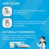 Salvasor Skin Treatment Cream - Eczema Psoriasis Cream for Dry, Itchy, Rough and Irritated Skin - Reduces Appearance of Skin Redness